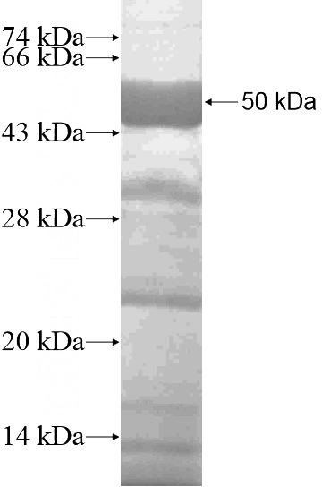 Recombinant Human SMARCD1 SDS-PAGE