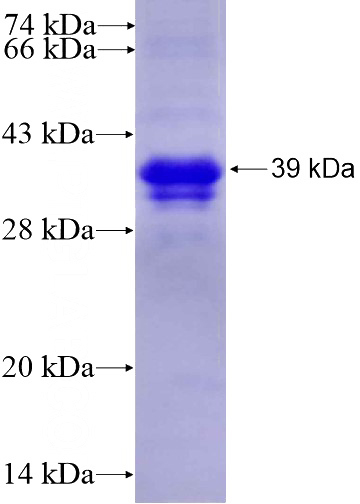 Recombinant Human GAS1 SDS-PAGE