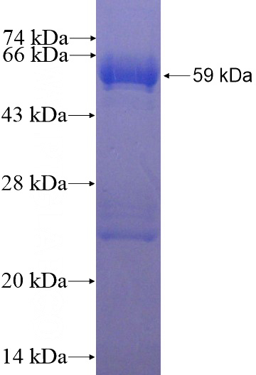 Recombinant Human GAS1 SDS-PAGE