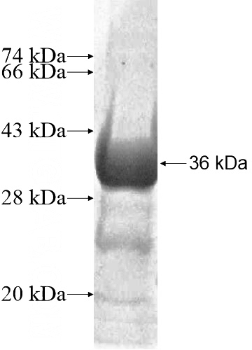 Recombinant Human HMGCL SDS-PAGE