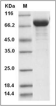 Human ENPP5 Protein (His Tag) SDS-PAGE