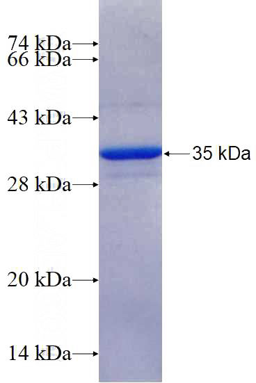 Recombinant Human C3orf10 SDS-PAGE