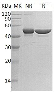 Human RRM2/RR2 (His tag) recombinant protein