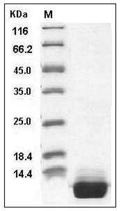 Human S100A10 Protein (His Tag) SDS-PAGE
