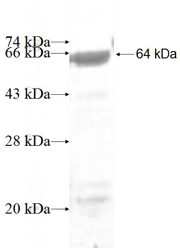 Recombinant Human GNB4 SDS-PAGE