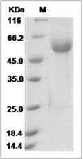 Human RAB1B Protein (Fc Tag)