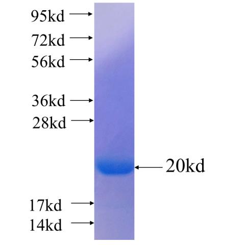 Recombinant human NKX2-2 SDS-PAGE