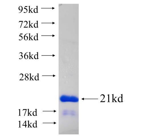 Recombinant human FNDC3A SDS-PAGE