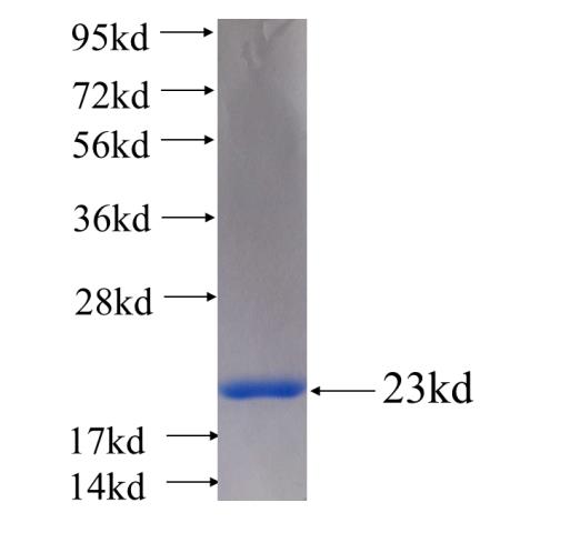 Recombinant human PRL3(Full length) SDS-PAGE