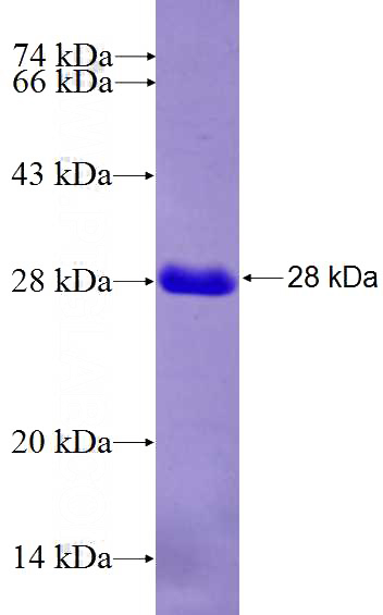 Recombinant Human ELF4 SDS-PAGE
