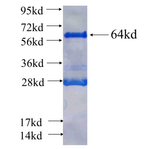 Recombinant human EIF4B SDS-PAGE