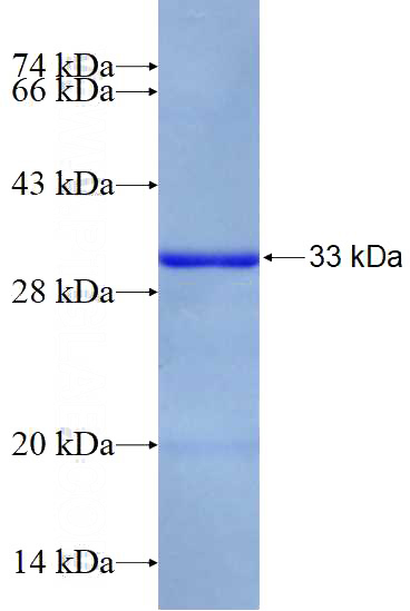 Recombinant Human ALY SDS-PAGE