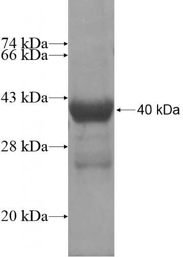 Recombinant Human GPRC5D SDS-PAGE