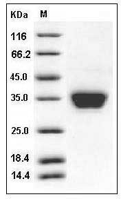 Mouse ASAM / CLMP Protein (His Tag) SDS-PAGE