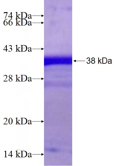 Recombinant Human LUC7L SDS-PAGE
