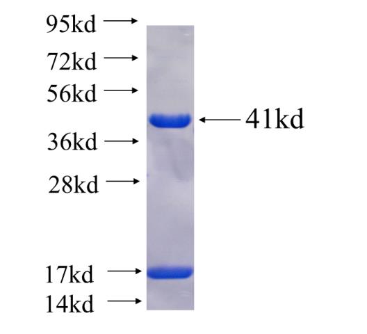 Recombinant human DEAF1 SDS-PAGE