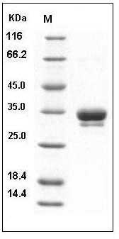 Human ASAM / CLMP Protein (His Tag) SDS-PAGE