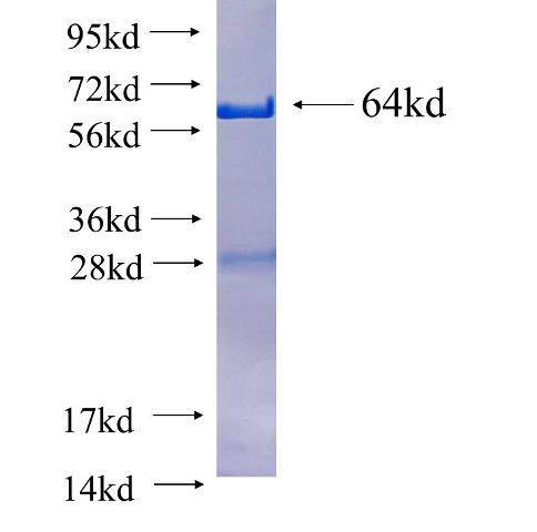 Recombinant human OSBPL9 SDS-PAGE