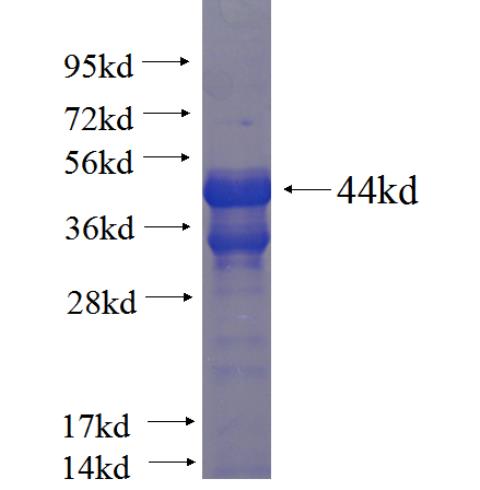 Recombinant human C14orf106 SDS-PAGE