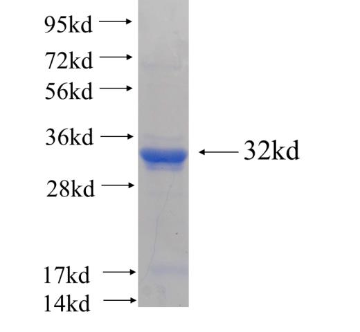 Recombinant human SFRS9(Full length) SDS-PAGE