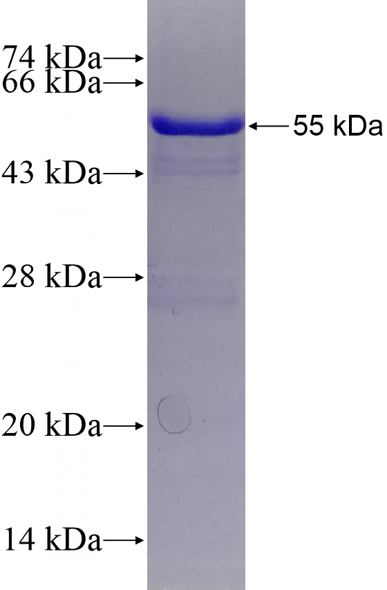 Recombinant Human CEP135 SDS-PAGE