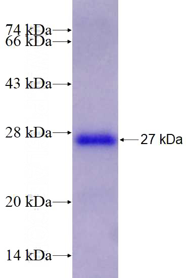 Recombinant Human ESRRG SDS-PAGE