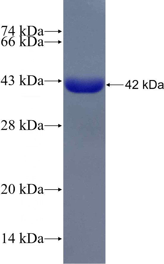 Recombinant Human GNE SDS-PAGE