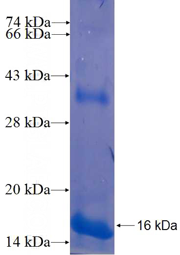 Recombinant Human FOXP3 SDS-PAGE