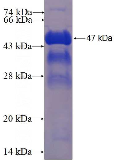 Recombinant Human CBX3 SDS-PAGE
