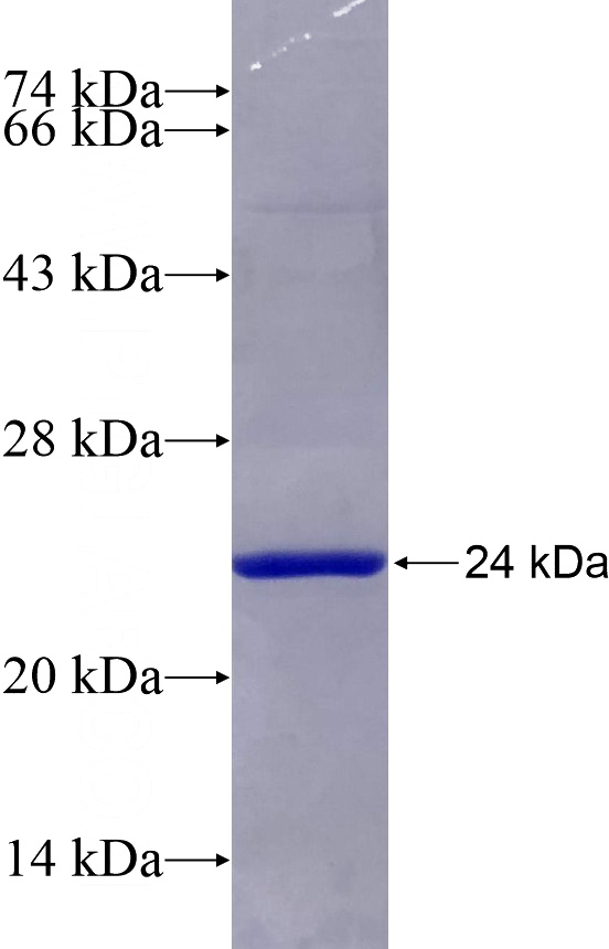 Recombinant Human RPL24 SDS-PAGE