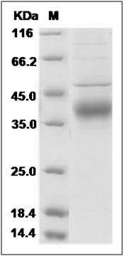 Human Angiopoietin 4 / ANG4 / ANGPT4 Protein (His Tag) SDS-PAGE