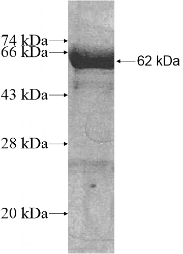 Recombinant Human ZFP64 SDS-PAGE