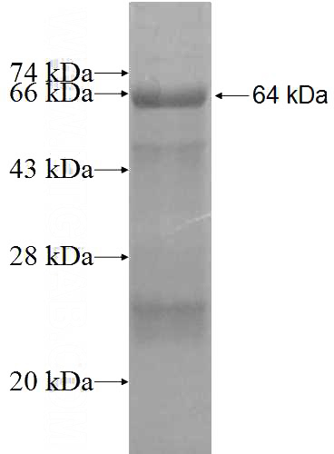 Recombinant Human LSS SDS-PAGE