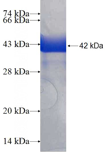 Recombinant Human POP7 SDS-PAGE