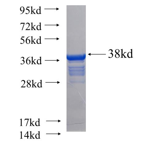 Recombinant human RPLP1 SDS-PAGE