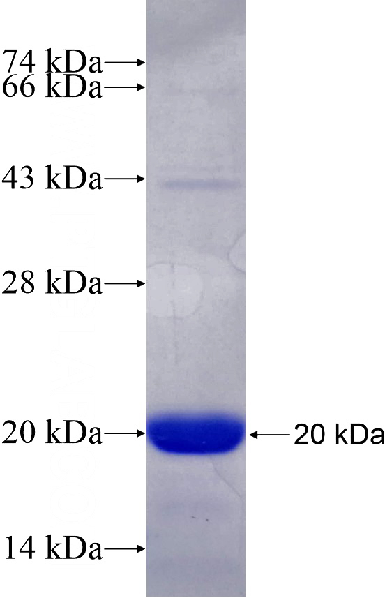Recombinant Human FOXP1 SDS-PAGE
