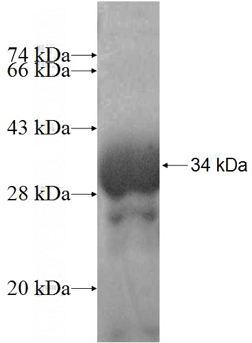 Recombinant Human CGRRF1 SDS-PAGE