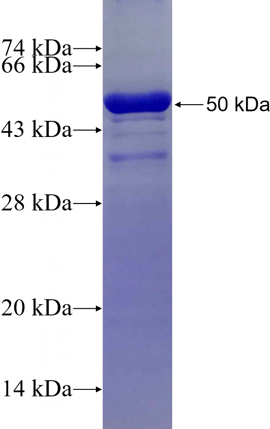 Recombinant Human PPM1B SDS-PAGE