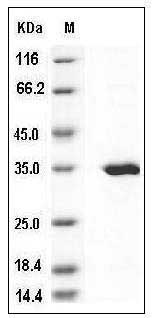Human SULT2A1 / STD Protein (His Tag) SDS-PAGE