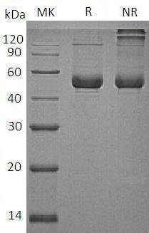 Human SERPINE2/PI7/PN1 (His tag) recombinant protein