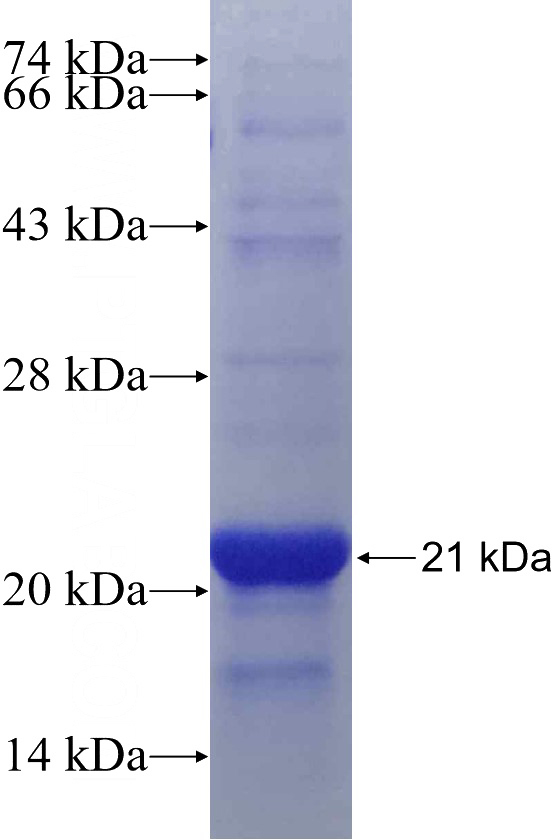 Recombinant Human LYSMD3 SDS-PAGE