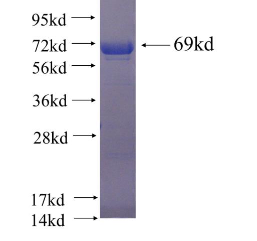 Recombinant human PRKAR1B(Full length) SDS-PAGE
