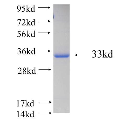 Recombinant human ERGIC1 SDS-PAGE