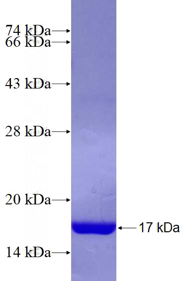Recombinant Human EIF1 SDS-PAGE
