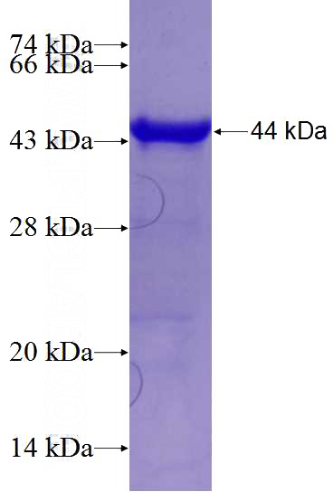 Recombinant Human LIG1 SDS-PAGE