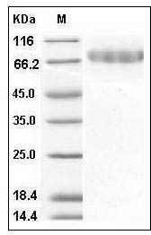 Mouse CLEC14A / EGFR-5 Protein (His Tag) SDS-PAGE