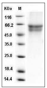 Human IL3RA / CD123 Protein (His Tag) SDS-PAGE