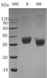 Human FAS/APT1/FAS1/TNFRSF6 (His tag) recombinant protein