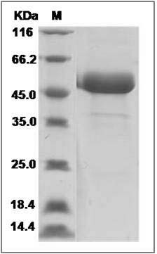 Human Frizzled-10 / FZD10 Protein (Fc Tag) SDS-PAGE