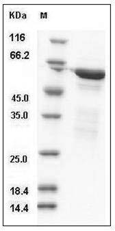 Human RELA / Transcription factor p65 / NFkB p65 Protein (aa 1-306, GST Tag) SDS-PAGE